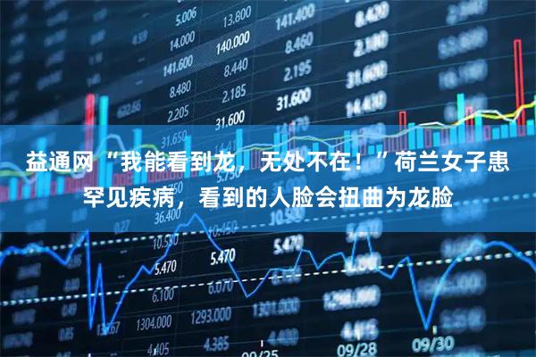 益通网 “我能看到龙，无处不在！”荷兰女子患罕见疾病，看到的人脸会扭曲为龙脸